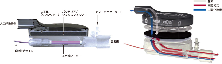 アナコンダ構造